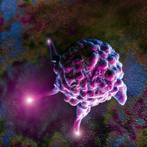 Cáncer de cuello uterino. Carcinoma in situ